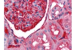 Immunohistochemical analysis of paraffin-embedded human Kidney tissues using anti-A1BG antibody (A1BG Antikörper)