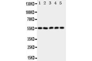 Western Blotting (WB) image for anti-Hyaluronidase-2 (HYAL2) (AA 142-157), (C-Term) antibody (ABIN3043041) (HYAL2 Antikörper  (C-Term))