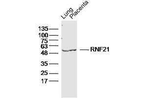 Lane 1: Mouse Lung lysates Lane 2: Mouse Placenta lysates probed with RNF21 Polyclonal Antibody, Unconjugated  at 1:300 dilution and 4˚C overnight incubation. (Protein RNF21 Antikörper)