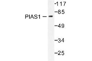Image no. 1 for anti-Protein Inhibitor of Activated STAT, 1 (PIAS1) antibody (ABIN271951) (PIAS1 Antikörper)