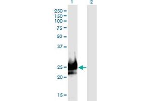 Western Blot analysis of DSCR6 expression in transfected 293T cell line by DSCR6 monoclonal antibody (M09), clone 1D1. (RIPPLY3 Antikörper  (AA 1-190))
