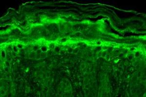 Immunohistochemistry analysis using Mouse Anti-Slo2. (KCNT1 Antikörper  (AA 1168-1237) (PE))