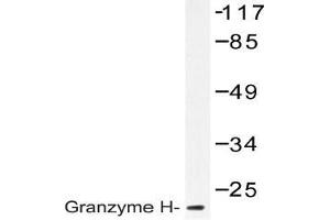 Western blot (WB) analysis of Granzyme H antibody in extracts from K562 cells. (GZMH Antikörper)