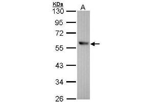WB Image Sample (30 ug of whole cell lysate) A: Hep G2 , 10% SDS PAGE antibody diluted at 1:1000 (ALDH1A1 Antikörper  (C-Term))