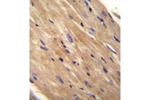 Formalin fixed, paraffin embedded Mouse heart tissue stained with RhoJ Antibody  followed by peroxidase conjugation of the secondary antibody and DAB staining. (RHOJ Antikörper  (Middle Region))