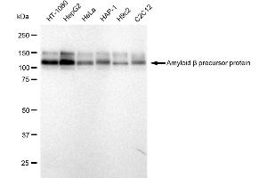 Western blotting analysis using Amyloid beta precursor protein antibody (ABIN7797593). (Rekombinanter APP Antikörper)