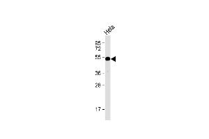 Anti-HtrA1 Antibody (N-term) at 1:1000 dilution + Hela whole cell lysate Lysates/proteins at 20 μg per lane. (HTRA1 Antikörper  (N-Term))