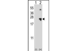 Western blot analysis of NME4 (arrow) using rabbit polyclonal NME4 Antibody (M1) (ABIN392784 and ABIN2842222).