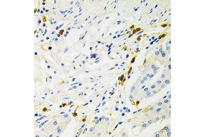 Immunohistochemistry of paraffin-embedded human stomach using NF-kB p65/RelA Antibody (ABIN3016234, ABIN3016235, ABIN3016236 and ABIN6219643) at dilution of 1:200 (40x lens). (NF-kB p65 Antikörper  (AA 50-180))