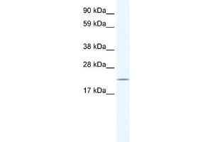 WB Suggested Anti-HTATIP2 Antibody Titration:  0. (HIV-1 Tat Interactive Protein 2, 30kDa (HTATIP2) (N-Term) Antikörper)