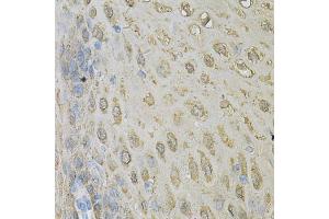 Immunohistochemistry of paraffin-embedded human esophagus using ALDH3A1 Antibody. (ALDH3A1 Antikörper)