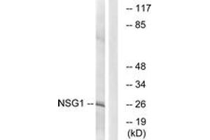 Western blot analysis of extracts from COLO cells, using NSG1 Antibody.