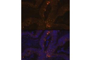 Immunofluorescence analysis of human colon carcinoma using TFF1/pS2 Rabbit mAb (ABIN7270972) at dilution of 1:100 (40x lens). (TFF1 Antikörper  (pSer2))