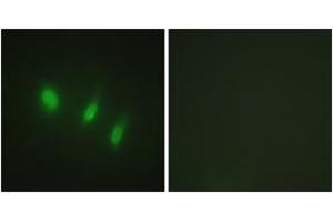 Immunofluorescence analysis of HeLa cells, using FOXO4 (Ab-451) Antibody. (FOXO4 Antikörper  (AA 417-466))