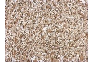 Immunohistochemistry (IHC) image for anti-Fibroblast Growth Factor 13 (FGF13) antibody (ABIN2854901)