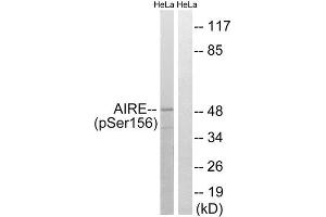 Western Blotting (WB) image for anti-Autoimmune Regulator (AIRE) (pSer156) antibody (ABIN1847730) (AIRE Antikörper  (pSer156))