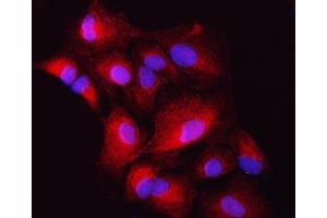 IF analysis of ZIP7/SLC39A7 using anti-ZIP7/SLC39A7 antibody (ABIN7600143).