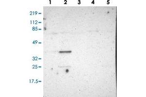 Western blot analysis of Lane 1: RT-4, Lane 2: U-251 MG, Lane 3: Human Plasma, Lane 4: Liver, Lane 5: Tonsil with PLSCR4 polyclonal antibody (PAB28547) at 1:100-1:250 dilution. (PLSCR4 Antikörper)