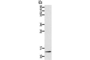 Gel: 12 % SDS-PAGE, Lysate: 40 μg, Lane: Mouse liver tissue, Primary antibody: ABIN7130906(RNF7 Antibody) at dilution 1/250, Secondary antibody: Goat anti rabbit IgG at 1/8000 dilution, Exposure time: 10 minutes