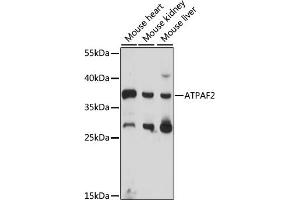 Western blot analysis of extracts of various cell lines, using  antibody (ABIN7265717) at 1000 dilution. (ATPAF2 Antikörper  (AA 41-200))