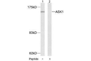 Western blot analysis of extract from MDA-MB- 435 cells, using ASK1 (Ab-83) antibody (E021125). (ASK1 Antikörper)