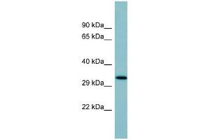 SFTPD antibody used at 1 ug/ml to detect target protein. (SFTPD Antikörper  (Middle Region))