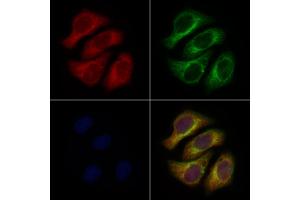 ABIN6260918 and ABIN6276952 staining Hela cells by IF/ICC. (CNTF Antikörper  (C-Term))