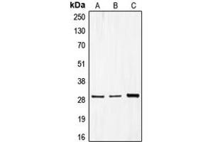 Western blot analysis of CDCA3 expression in MCF7 (A), Caco2 (B), HepG2 (C) whole cell lysates. (CDCA3 Antikörper  (C-Term))