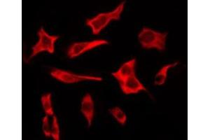 ABIN6276224 staining COLO205 by IF/ICC. (TAS2R19 Antikörper  (Internal Region))