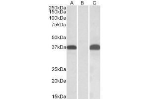 Western Blotting (WB) image for anti-Proto-Oncogene Pim-2 (Serine Threonine Kinase) (PIM2) (AA 23-36) antibody (ABIN5904200) (PIM2 Antikörper  (AA 23-36))