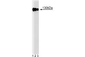 Western Blotting (WB) image for anti-Integrin beta 1 (ITGB1) (AA 76-256) antibody (ABIN967992) (ITGB1 Antikörper  (AA 76-256))