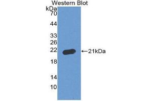 Western Blotting (WB) image for anti-Apoptosis-Associated tyrosine Kinase (AATK) (AA 1216-1374) antibody (ABIN3208648) (AATK Antikörper  (AA 1216-1374))