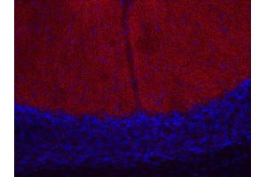 Immunohistochemistry (IHC) image for anti-Calcium Channel, Voltage-Dependent, N Type, alpha 1B Subunit (CACNA1B) antibody (ABIN2850858)