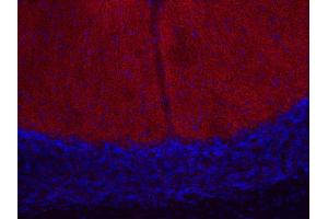 Indirect immunostaining of PFA fixed mouse cerebellum section (dilution 1 : 200; red). (CACNA1B Antikörper)