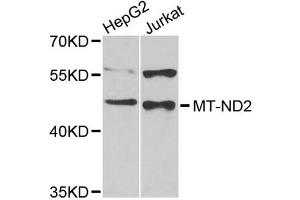 Western blot analysis of extracts of various cell lines, using MT-ND2 antibody (ABIN5998276) at 1/1000 dilution.
