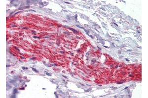 Nerve, Human: Formalin-Fixed, Paraffin-Embedded (FFPE) (Ankyrin G Antikörper)