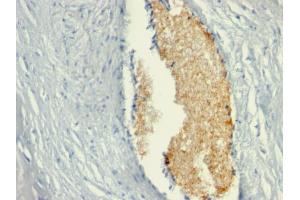 Formalin-fixed, paraffin-embedded human Placenta stained with AMPD3 Mouse Monoclonal Antibody (AMPD3/901) (AMPD3 Antikörper)