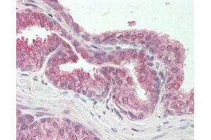 Immunohistochemistry (IHC) image for anti-SWI/SNF Related, Matrix Associated, Actin Dependent Regulator of Chromatin, Subfamily D, Member 2 (SMARCD2) (AA 440-489) antibody (ABIN6755414)