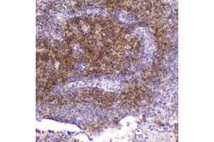 Immunohistochemistry (IHC) image for anti-Fatty Acid Binding Protein 3, Muscle and Heart (FABP3) (AA 2-133) antibody (ABIN6654044)