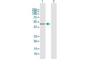 Western Blot analysis of ACADM expression in transfected 293T cell line by ACADM MaxPab polyclonal antibody. (Medium-Chain Specific Acyl-CoA Dehydrogenase, Mitochondrial (MCAD) (AA 1-421) Antikörper)