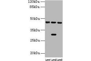 Western blot All lanes: HPD antibody at 4. (HPD Antikörper  (AA 2-393))