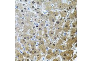 Immunohistochemistry of paraffin-embedded human liver damage using RNF166 antibody (ABIN6135036, ABIN6147021, ABIN6147024 and ABIN6224290) (40x lens). (RNF166 Antikörper  (C-Term))