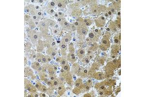 Immunohistochemistry of paraffin-embedded human liver damage using RNF166 antibody (ABIN6135036, ABIN6147021, ABIN6147024 and ABIN6224290) (40x lens).