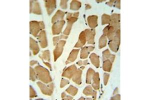 Immunohistochemistry analysis in formalin fixed and paraffin embedded skeletal muscle reacted with GLG1 Antibody (C-term) followed which was peroxidase conjugated to the secondary antibody and followed by DAB staining.