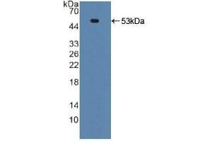 Detection of Recombinant TNFRSF10B, Human using Polyclonal Antibody to Death receptor 5 (DR5) (TNFRSF10B Antikörper  (AA 234-435))