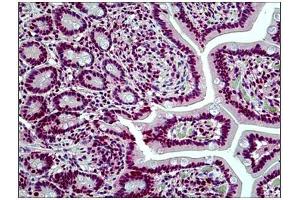 Human Small Intestine: Formalin-Fixed, Paraffin-Embedded (FFPE) (SMARCA4 Antikörper  (N-Term))