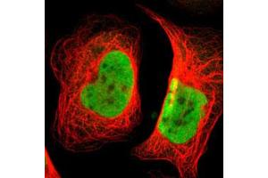 Immunofluorescent staining of U-2 OS with SMARCE1 polyclonal antibody  (Green) shows positivity in nucleus but excluded from the nucleoli. (SMARCE1 Antikörper)