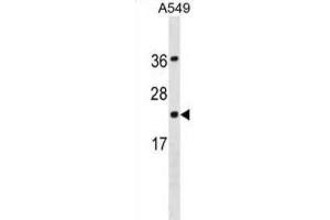 Western Blotting (WB) image for anti-Programmed Cell Death 6 (PDCD6) antibody (ABIN3001218) (PDCD6 Antikörper)