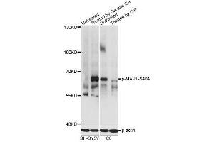 Western blot analysis of extracts of SH-SY5Y and C6 cells, using Phospho-MAPT-S404 antibody (ABIN2987503) at 1/2000 dilution. (MAPT Antikörper  (pSer404))