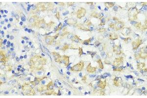 Immunohistochemistry of paraffin-embedded Human stomach using CTSB Polyclonal Antibody at dilution of 1:100 (40x lens). (Cathepsin B Antikörper)